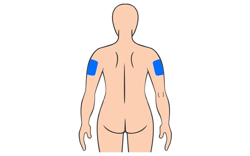 Peptide Pen Upper Arm Peptide Pen Upper Arm